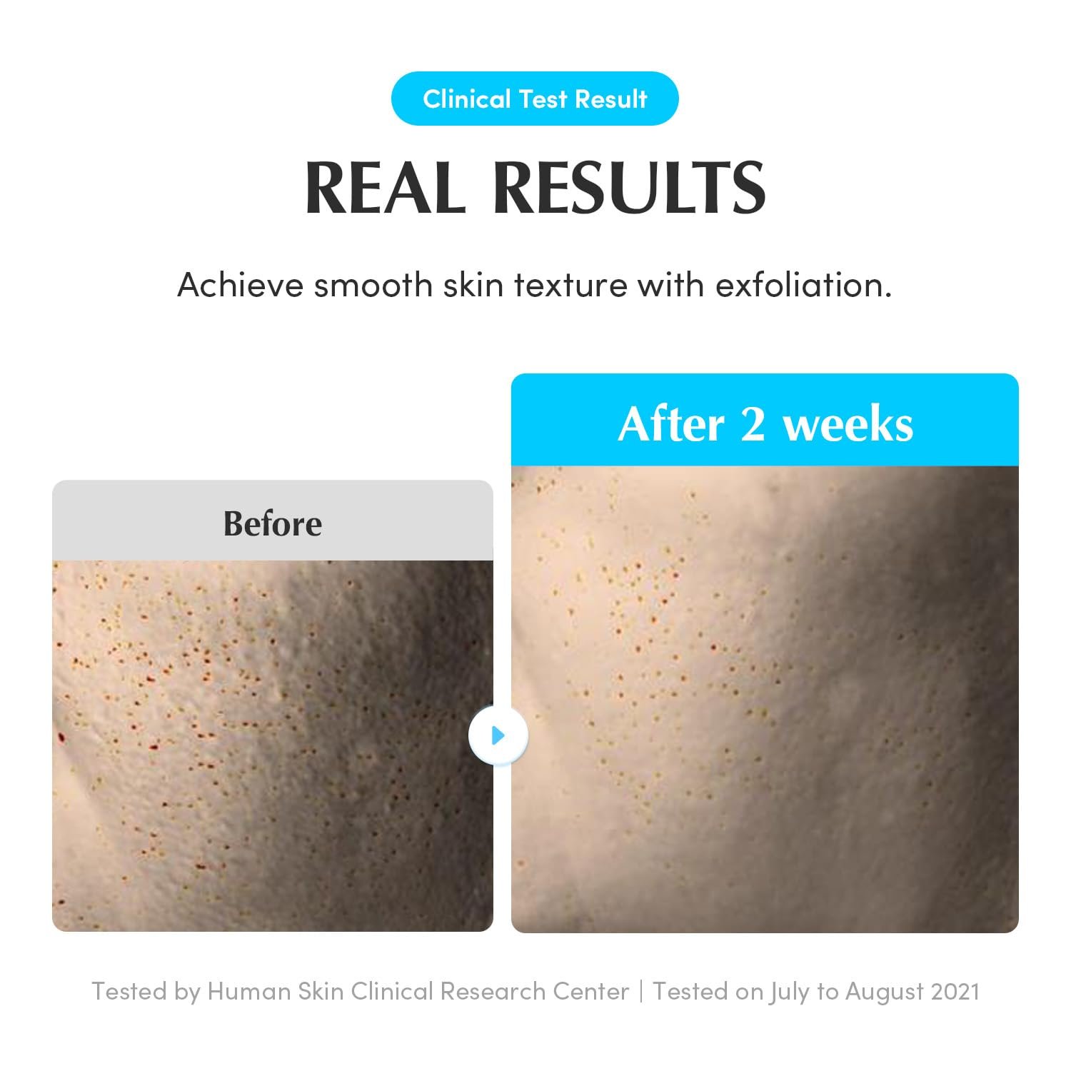 EQQUALBERRY Swimming Pool Toner (300ml) - Image 4