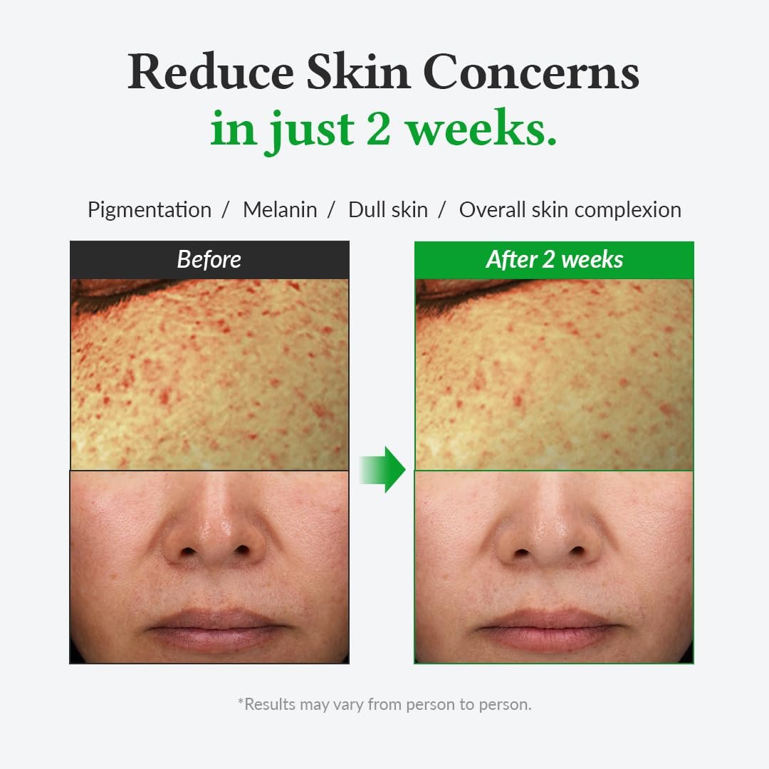 Dr. Althea Gentle Vitamin C Serum (30ml) - Image 3