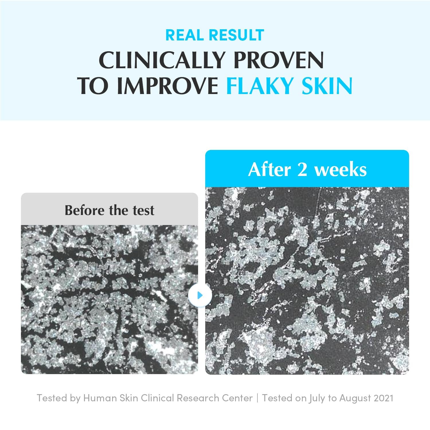 EQQUALBERRY Swimming Pool Toner (300ml) - Image 5