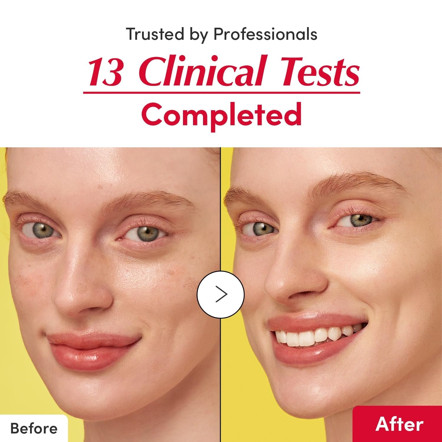 EQQUALBERRY Vitamin illuminating Serum (30ml) - Image 5